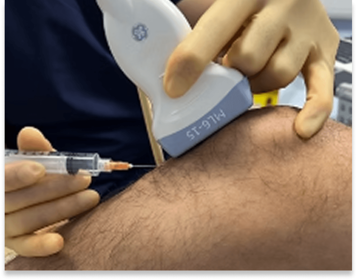 Ultrasound-guided needle placement